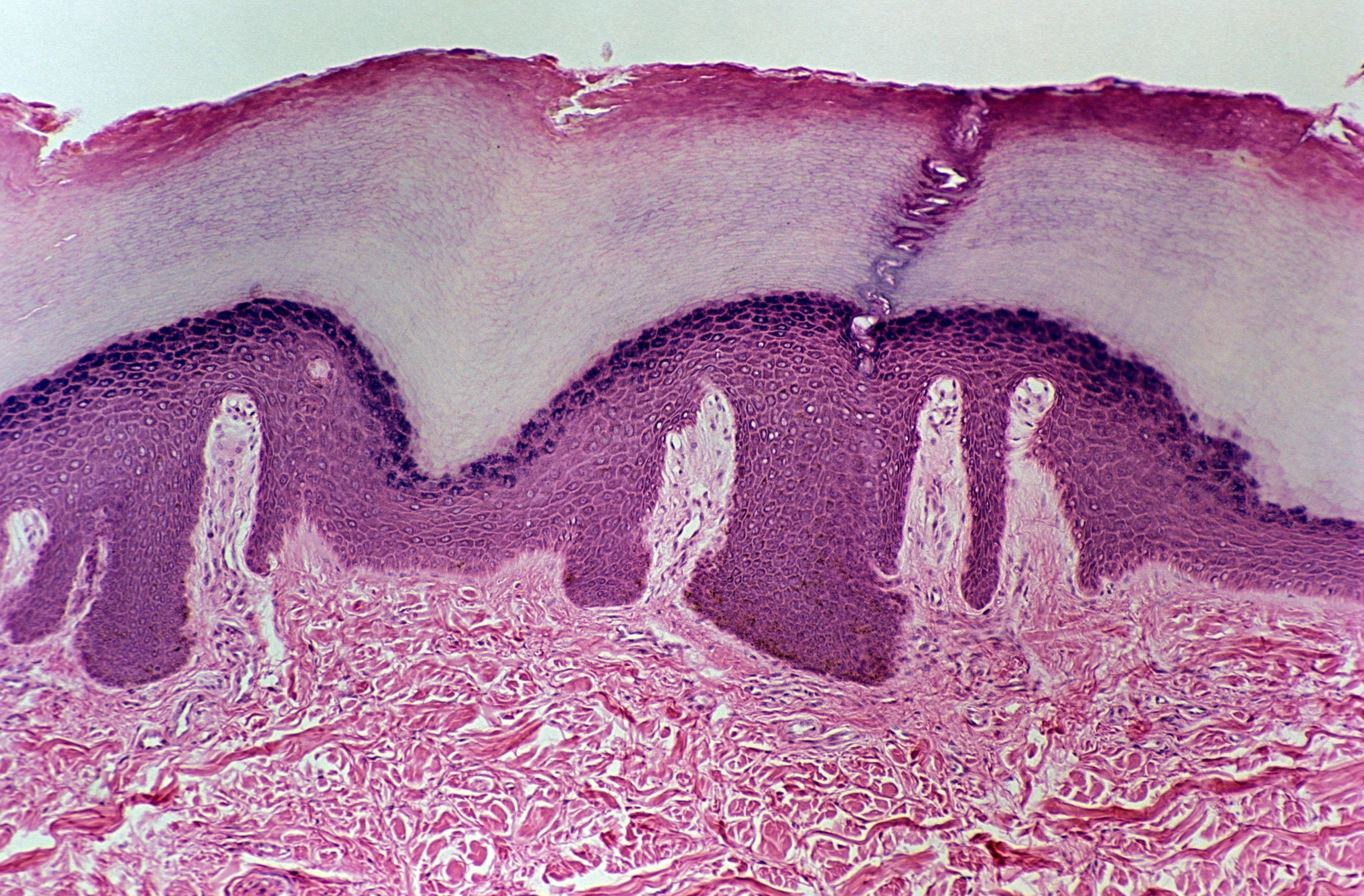 Microscopic image showing a cross-section of human skin. The outer layer (epidermis) is stained a dark pink-purple and appears undulating, with projections into the lighter pink dermis below, which is composed of a fibrous matrix.